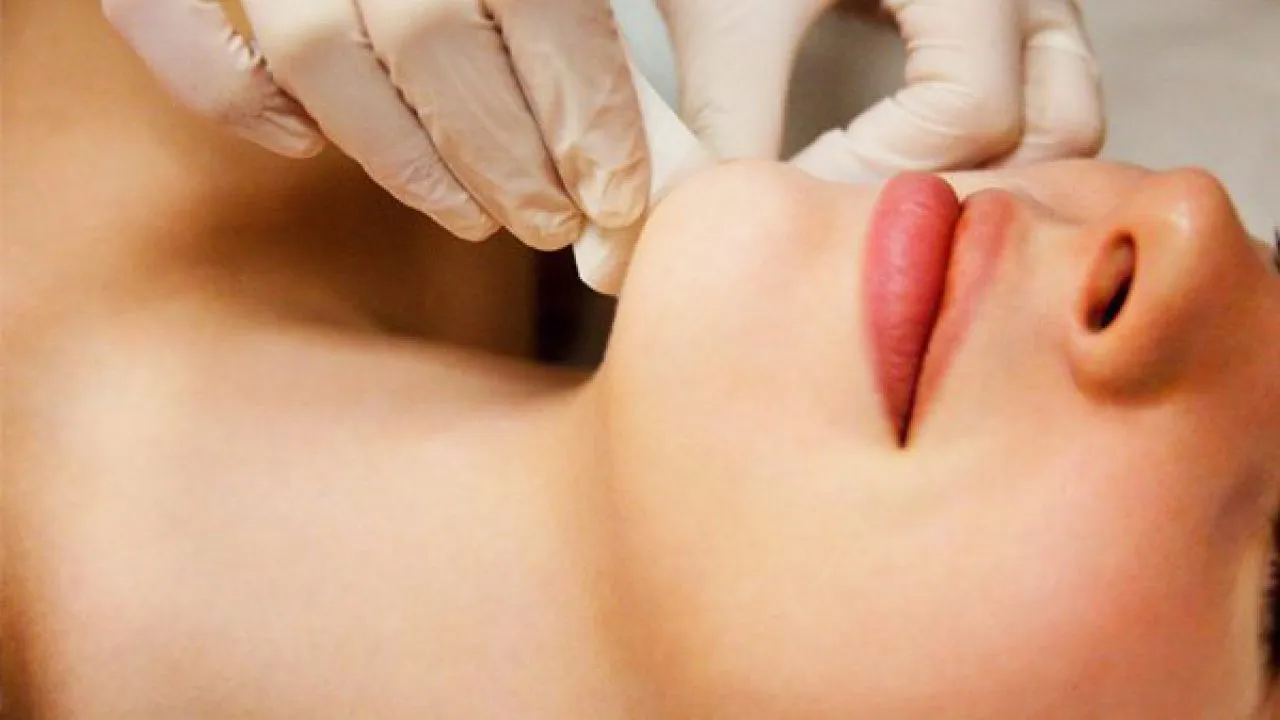 Chin Sugaring